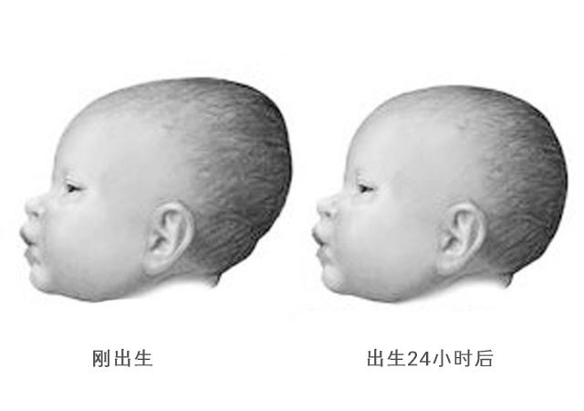 宝宝九个月囟门闭合，成长过程中的重要里程碑